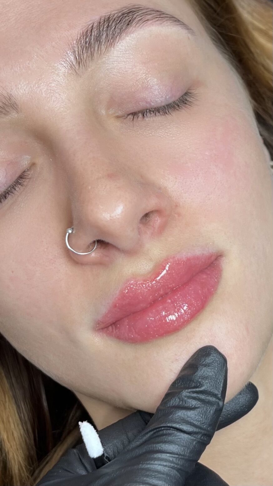 Aesthetic treatments and injectables in Birstall, Leicester